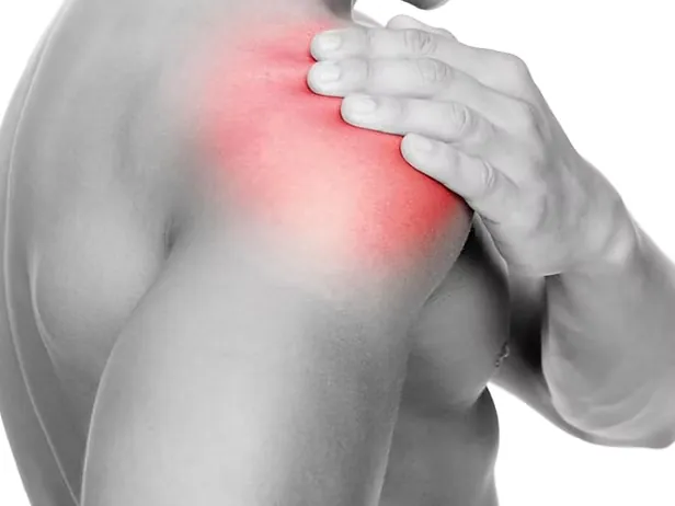 Traitement des tendinites de l'épaule — ostéopathe Paris 16
